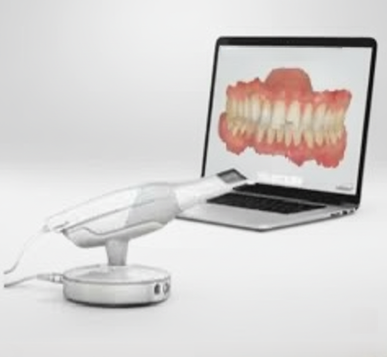 南港暁美牙醫診所採用口掃機技術，即時建立3D口腔模型，適用顳顎關節障礙、雷射牙齒美白，近Lalaport專攻數位齒顎矯正、舌側隱形矯正、兒童牙科